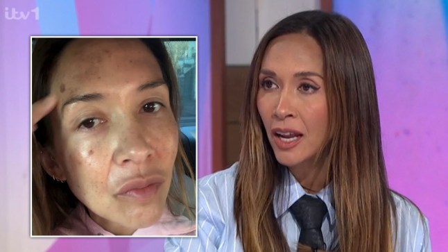 Myleene Klass on Loose Women, inset picture shows her bare-face after IPL treatment